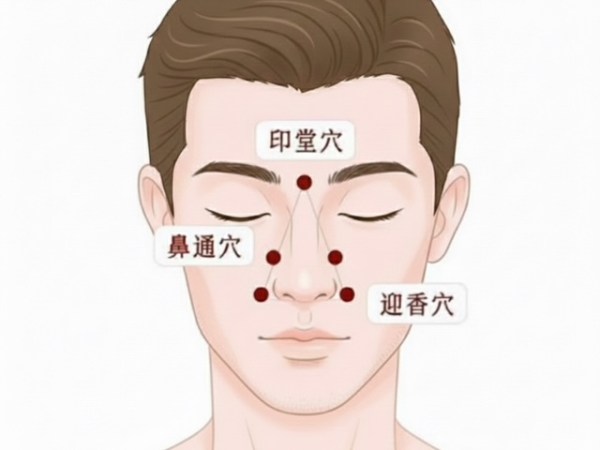 舒緩「鼻過敏」穴位按摩